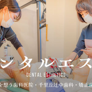デンタルエステ